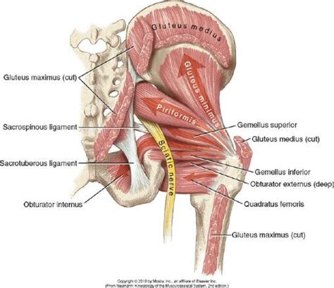 What is the recovery time? Piriformis syndrome on Pinterest