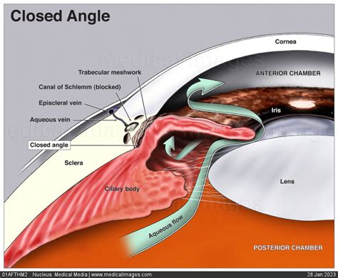 Stock Image Illustration Of The Eye Anatomy Closed Angle Cornea Sclera