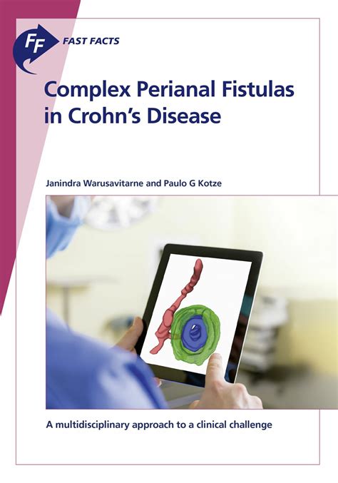 Fast Facts Complex Perianal Fistulas In Crohn S Disease E Book