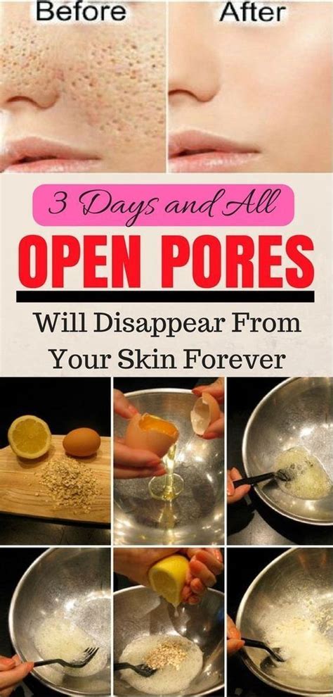 How To Make Pores Disappear Naturally How To Make Pores Smaller On