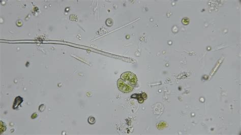 Microorganisms In Pond Water Under Microscope