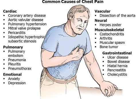 Anatomy Of Chest Pain Rotation Of 3d Skeletonribschestanatomy