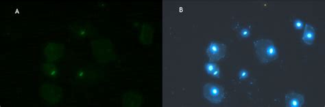 vaginal smear slide stained with sperm hy liter and visualized in download scientific diagram