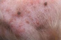 Dermatite Allergica Da Pulci Nei Cani Mondopets It