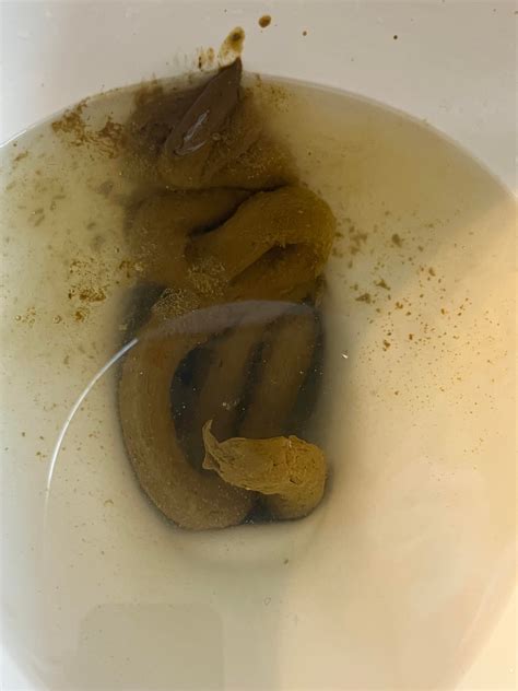 Can Someone Explain Why My Poop Has A Red Tint To It Rpoop