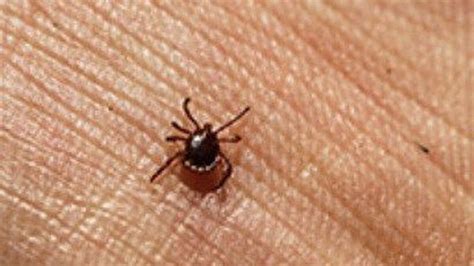 Woman Allergic To Meat Years After Tick Bite