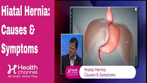 Hiatal Hernia Causes Symptoms YouTube