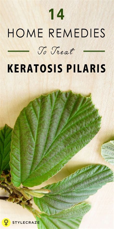 14 Home Remedies To Treat Keratosis Pilaris Bumps On The Skin