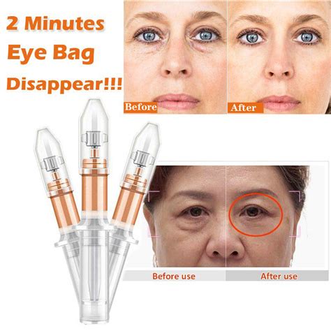 Buy 2 Min Instantly Eye Bag Removal Cream Puffiness Wrinkles Fine Lines