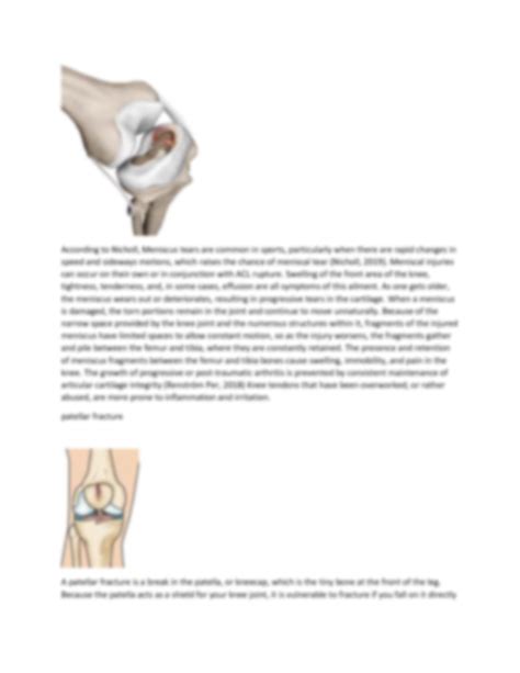Solution The Anatomy Of The Knee Injuries Studypool