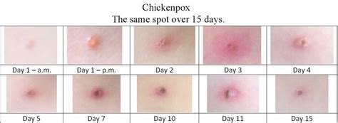 Pin on Health Tips