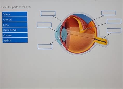 Solved Label The Parts Of The Eye Sclera Choroid Lens Optic