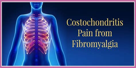 What Does Costochondritis Causes Symptoms And Treatment K Health