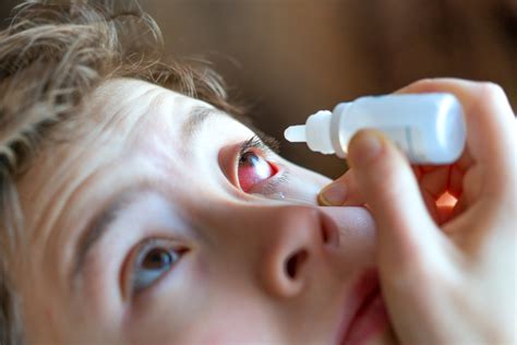 Together with our patients, we. Dealing with conjunctivitis in kids | House Call Doctor
