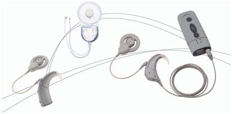 The Development Of The Nucleus Freedom Cochlear Implant System
