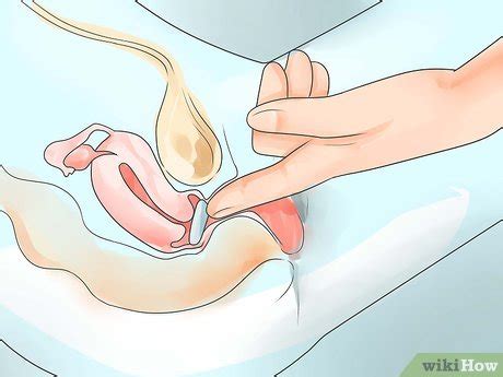 How To Insert A Pessary With Pictures WikiHow