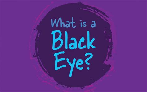 What Is A Black Eye Common Causes And Symptoms Of A Black Eye