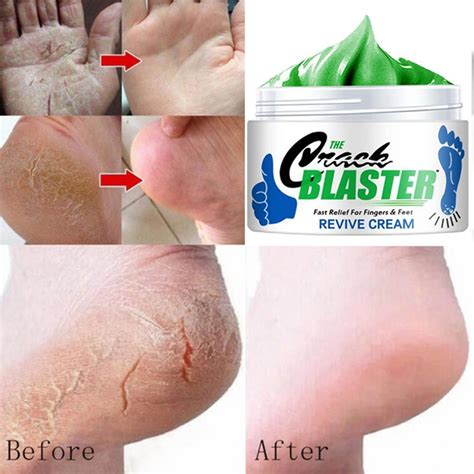 15g 30g 50g Cracked Heel Repair Cream Deeply Moisturize Soften Skin Dry Feet Treatment Rough