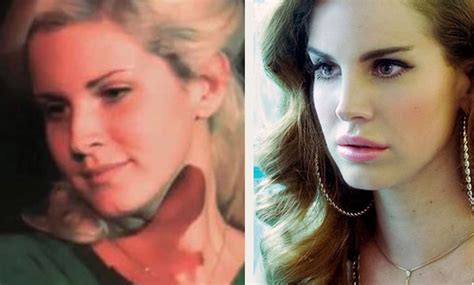 Could This Be The Case With Lana Del Rey Plastic Surgery