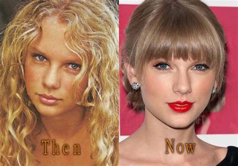 Taylor Swift Plastic Surgery Before After Boob Job Nose Job