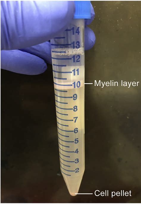 Photograph Of The Myelin Layer And Cell Pellet After Percoll Gradient