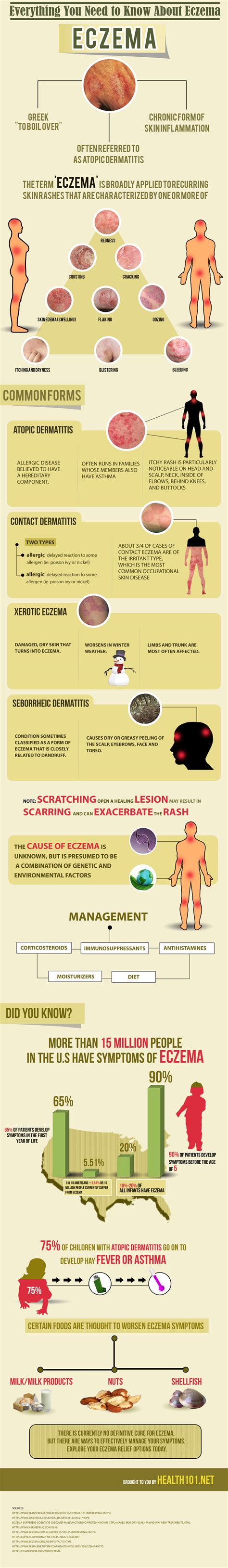 Facts About Eczema Heres What You Need To Know Ct Dermatologist