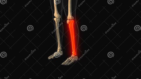 Medical Animation Of The Tibia Fibula Bone Pain Stock Illustration