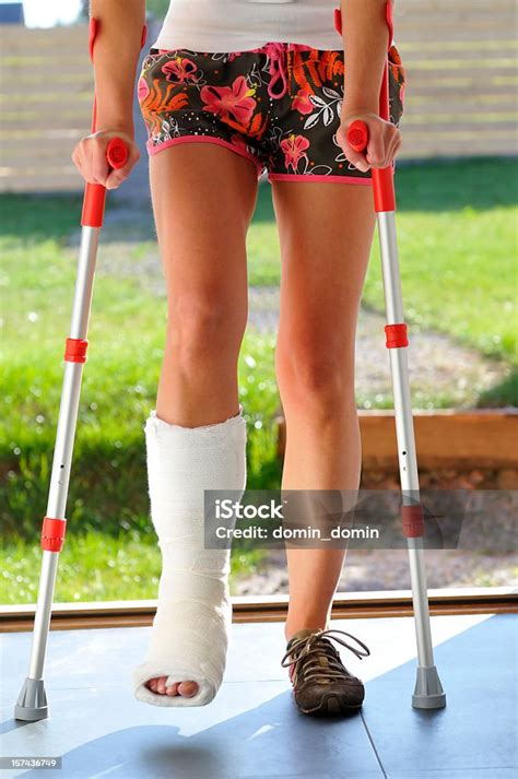 Woman With Broken Leg Twisted Ankle Bandage Walking On Crutches Stock