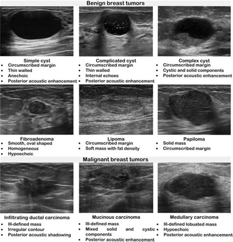 Description Of The Sonographic Appearance Exhibited By Different Breast