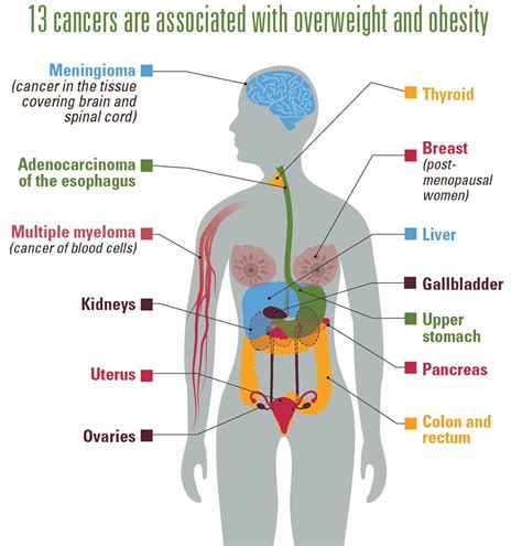 Overweight And Obesity Leading Cancer Risk Factor