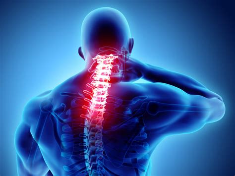 Symptoms Of Spinal Arthritis Chronic Pain Back Pain Risk Factors