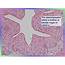 EPITHELIAL TISSUE Flashcards By ProProfs