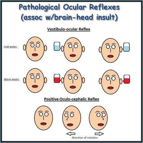 The Stages Of Facial Reflexs And Their Corresponding Areas In Which One
