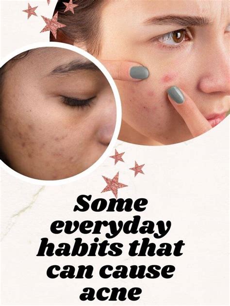 Some Everyday Habits That Can Cause Acne The Indian Express