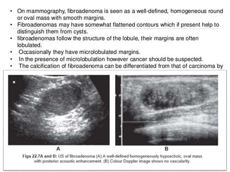 Imaging Of Breast Pathologies