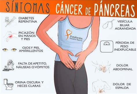 Sanidad Canaria Día Mundial Del Cáncer De Páncreas Concienciación Y