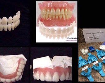 Extractions, dental fillings, and partial dentures have enabled him to chew and speak normally after years of upload, livestream, and create your own videos, all in hd. Pin on Veneers teeth