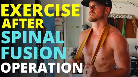 Exercise After Spinal Fusion Operation Practical Tips For Exercise