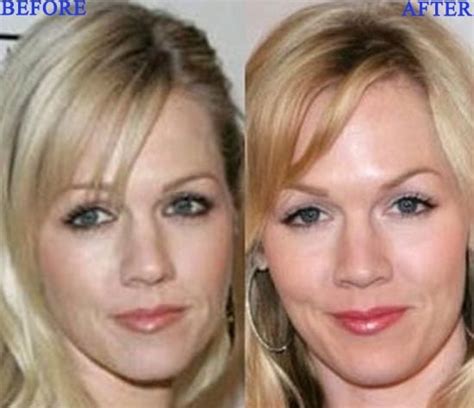 Jennie Garth Plastic Surgery Photo Before And After Celeb Surgery