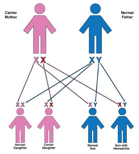 A Normal Man Marries A Woman Who Is A Carrier For Colour Blindness What Will Be The