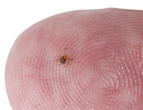 Black Legged Ticks Are Now Widespread In Vermont And Half Carry Lyme