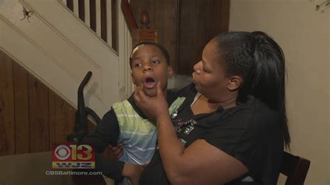 Mom Wants Answers After Son Has Teeth Pulled Without Her Permission