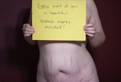 Website Celebrates Real Moms Beauty Stretch Marks And All