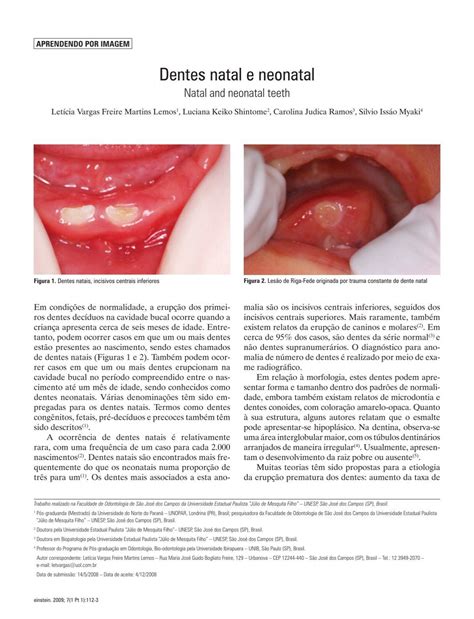 Dentes Natais E Neonatais