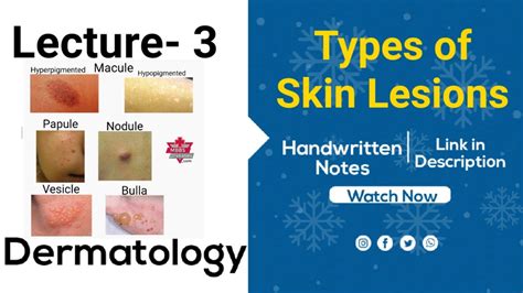 Types Of Skin Lesions Dermatology Lecture 3 Link For Handwritten