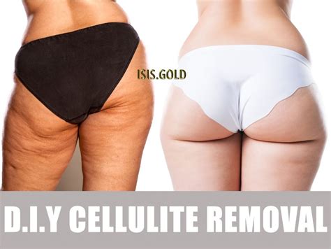 How To Get Rid Of Cellulite On Thighs Buttocks Best Cellulite Treatment Best Skincare And