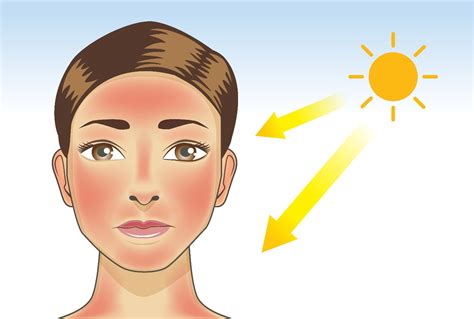 Symptoms And Causes Of Polymorphic Light Eruption Facty Health