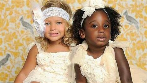 These Twins Skin Colors Varied When They Were Born See How They Appear 20 Years Later Just
