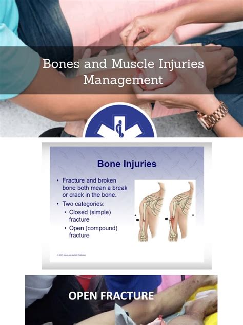 Bone And Muscles Injuries Pdf
