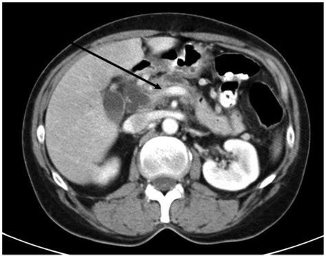 Maybe you would like to learn more about one of these? Cancers | Free Full-Text | Current State of Surgical ...